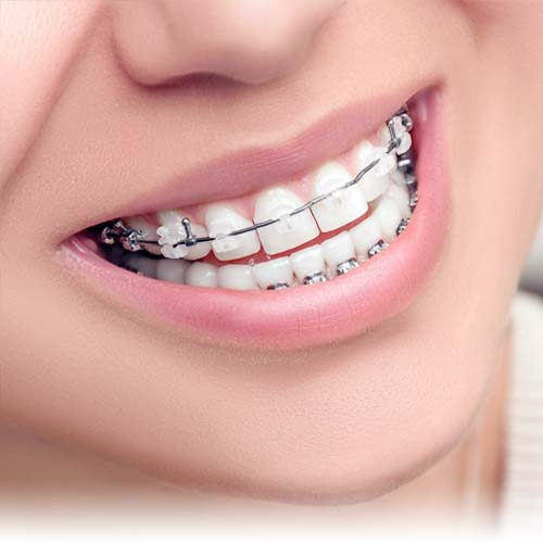 Услуга: ортодонтология